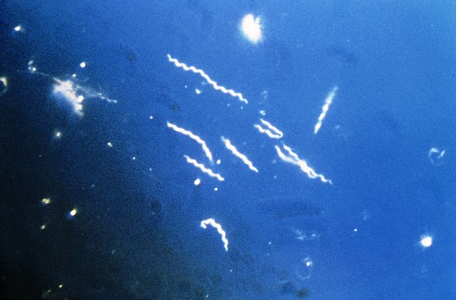 640px-Borrelia_burgdorferi_(CDC-PHIL_-6631)_lores